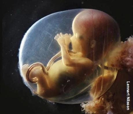 The foetus’ brain is significantly bigger than its heart and research suggests