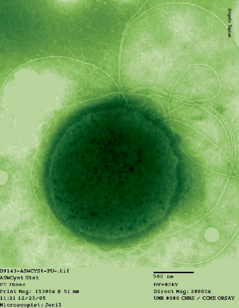 Microphotograph of the Archea Thermococcus Gammatolerans.