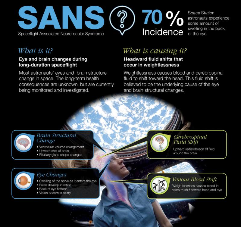 Long-duration astronauts may experience some or all of the changes illustrated in this SANS graphic from NASA.